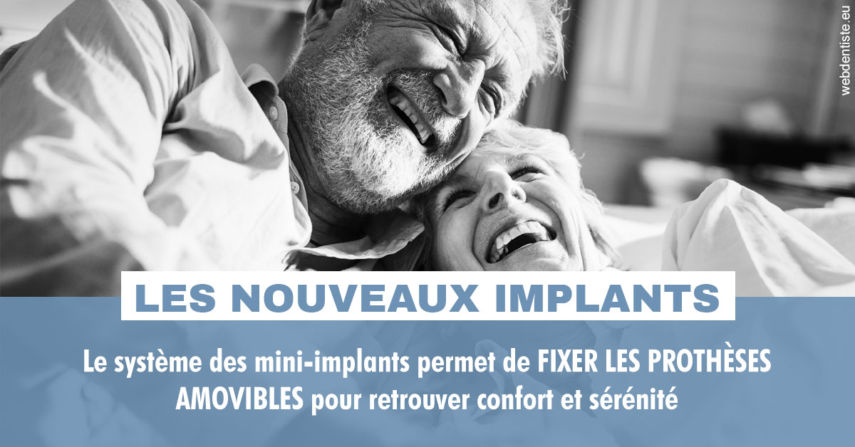 https://dr-goffoz-jf.chirurgiens-dentistes.fr/Les nouveaux implants 2