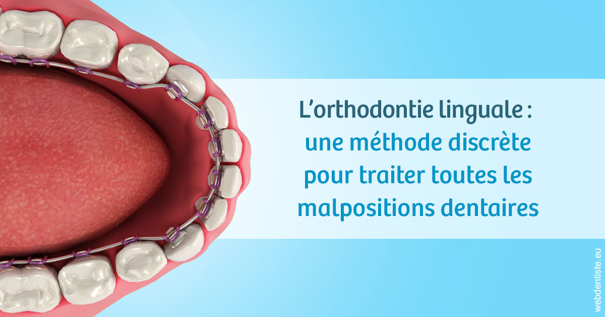 https://dr-goffoz-jf.chirurgiens-dentistes.fr/L'orthodontie linguale 1