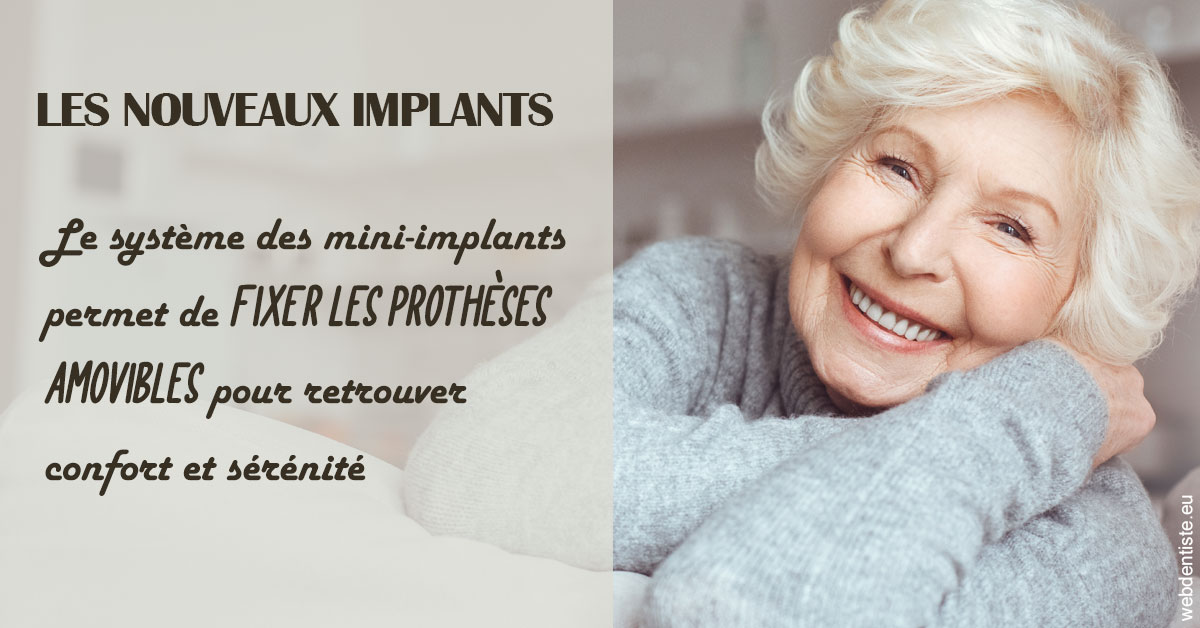 https://dr-goffoz-jf.chirurgiens-dentistes.fr/Les nouveaux implants 1