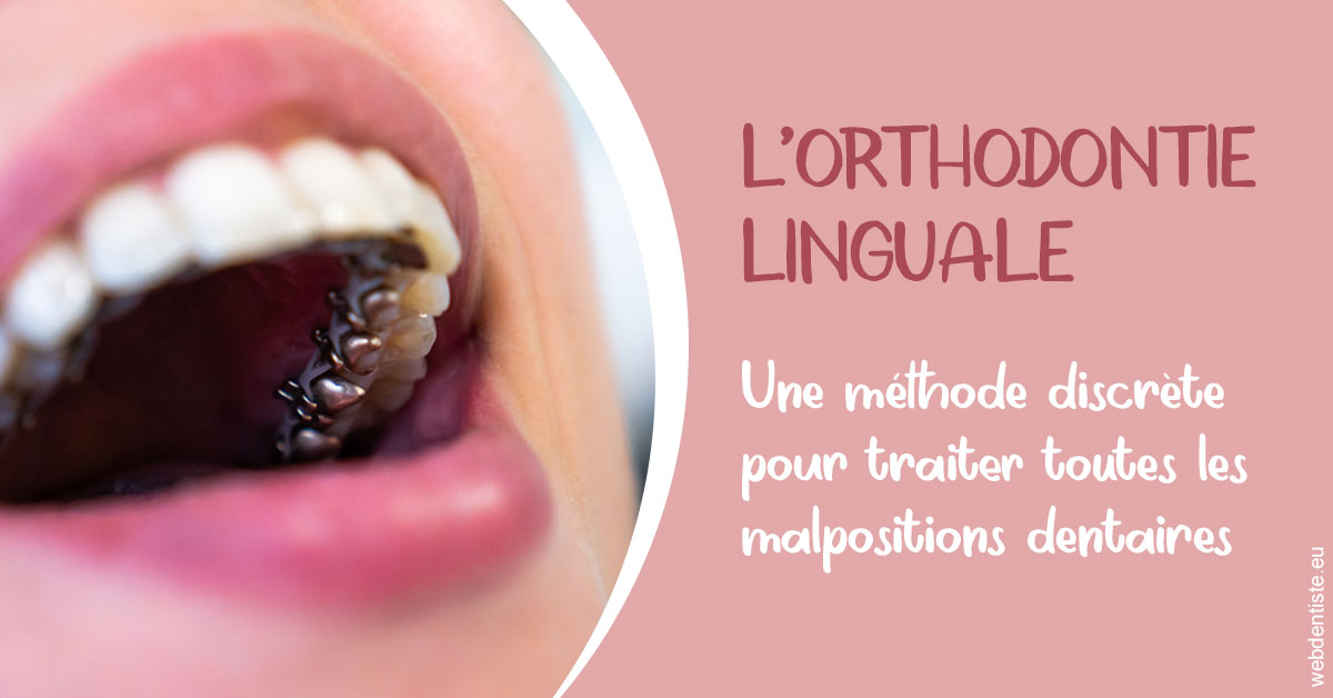 https://dr-goffoz-jf.chirurgiens-dentistes.fr/L'orthodontie linguale 2