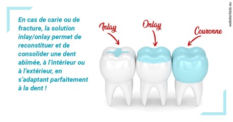 https://dr-goffoz-jf.chirurgiens-dentistes.fr/L'INLAY ou l'ONLAY
