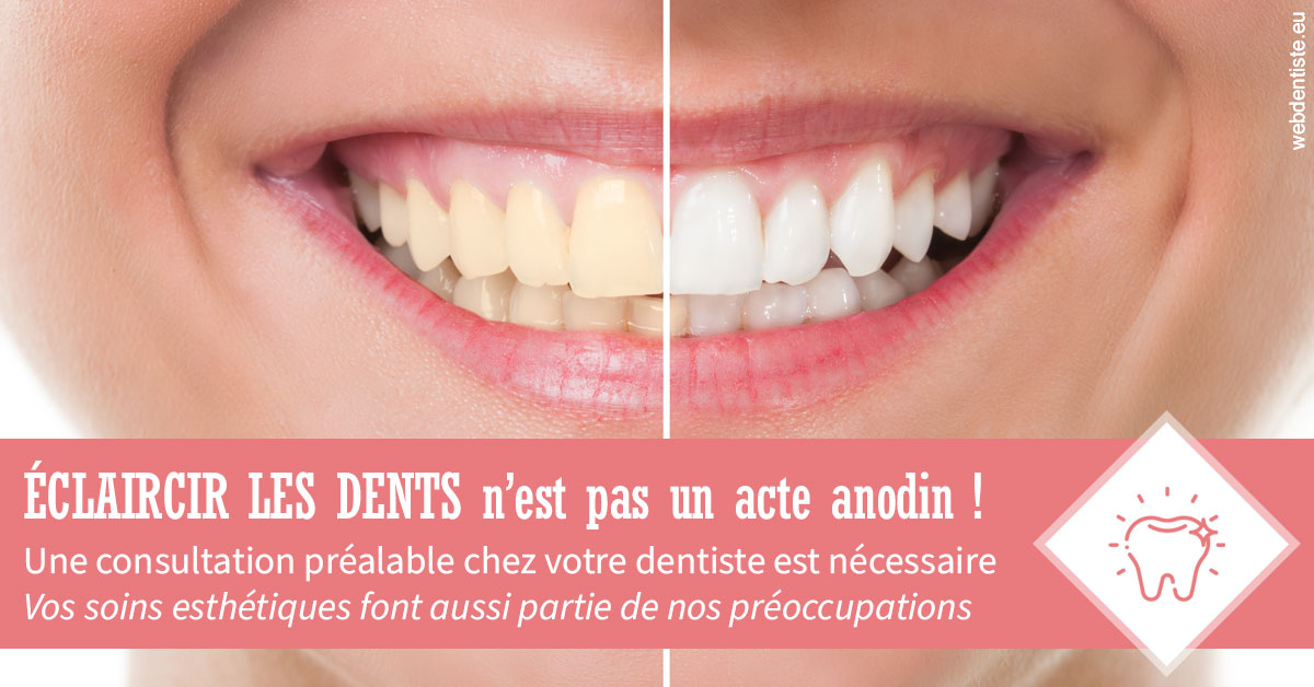 https://dr-goffoz-jf.chirurgiens-dentistes.fr/Eclaircir les dents 1