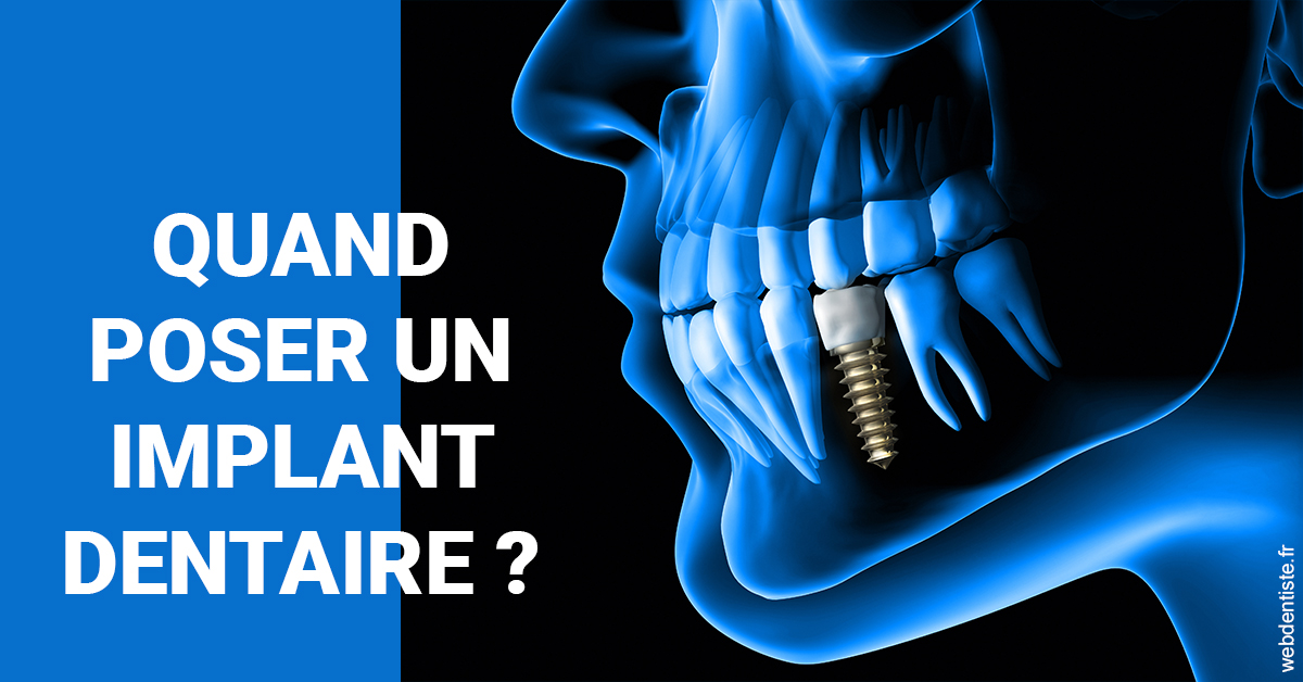 https://dr-goffoz-jf.chirurgiens-dentistes.fr/Les implants 1