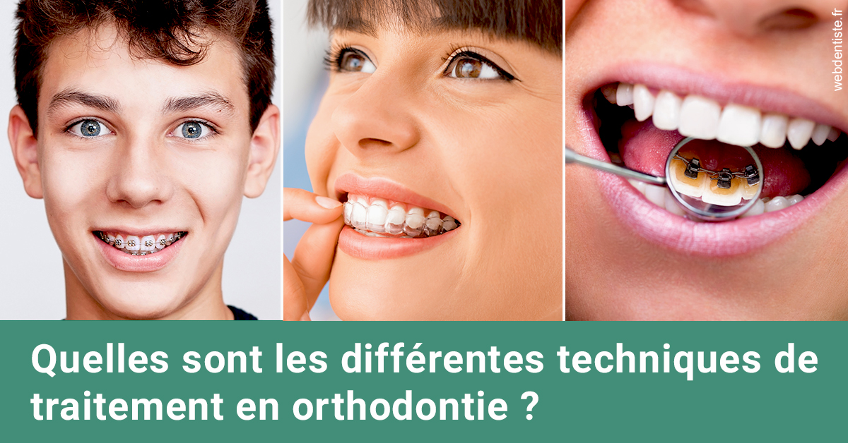 https://dr-goffoz-jf.chirurgiens-dentistes.fr/Les différentes techniques de traitement 2