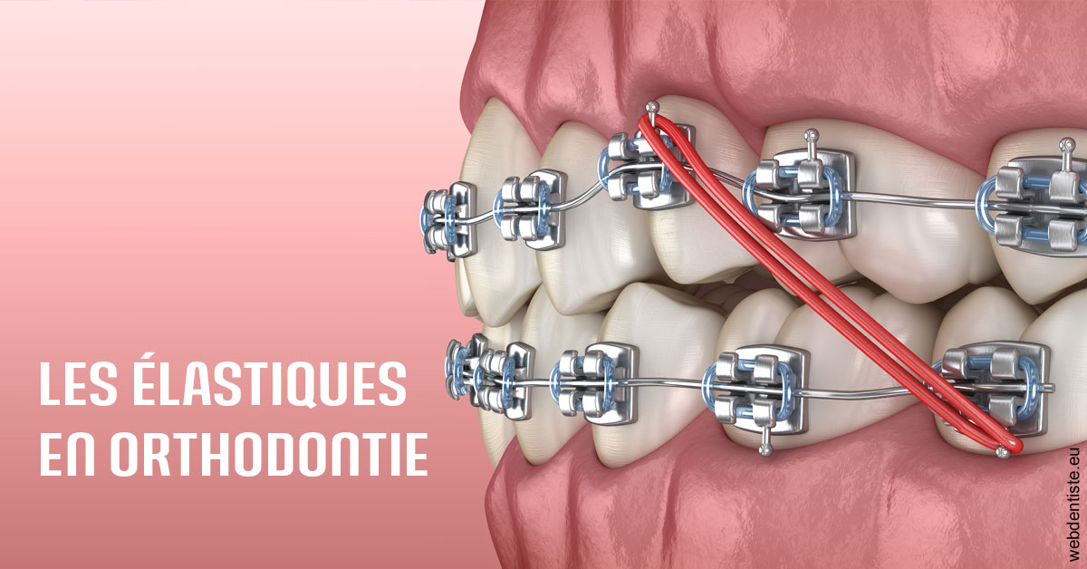 https://dr-goffoz-jf.chirurgiens-dentistes.fr/Elastiques orthodontie 2