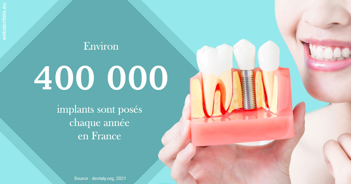 https://dr-goffoz-jf.chirurgiens-dentistes.fr/Pose d'implants en France 2